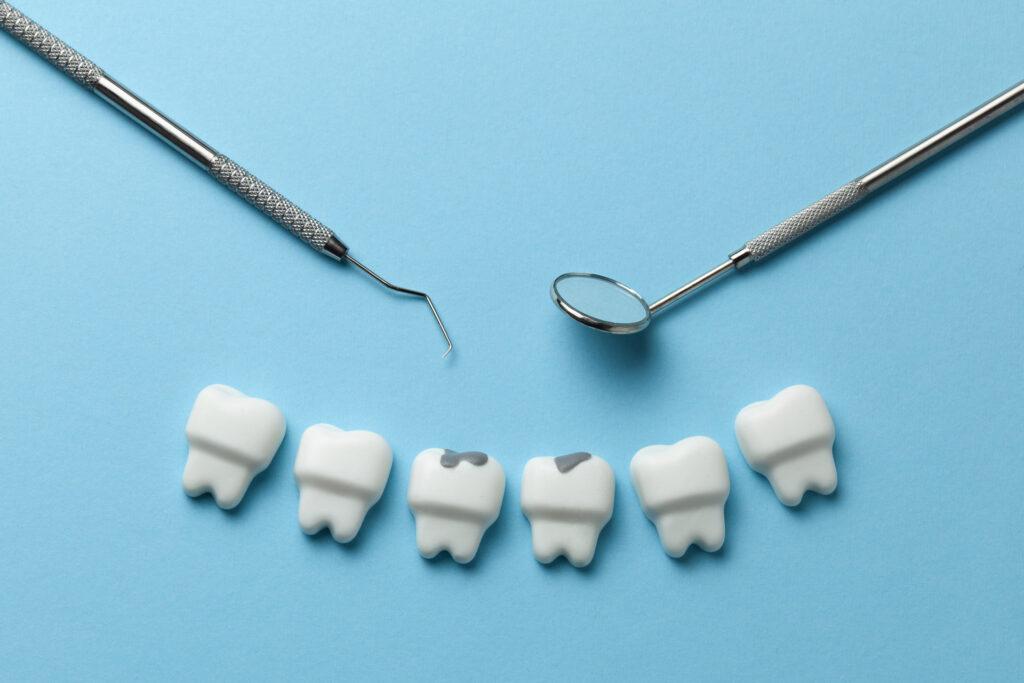 Sellado de fisuras en dentición infantil